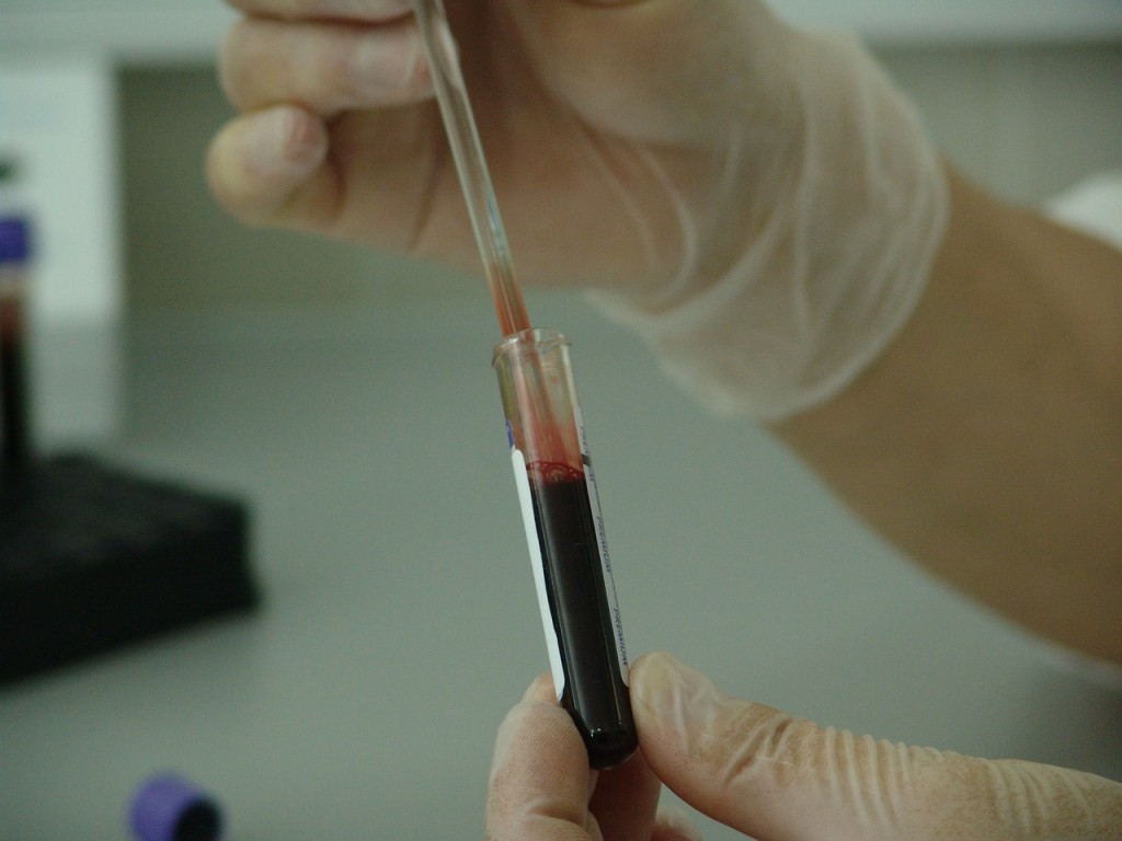 Fatal blood disease under an intern's microscope